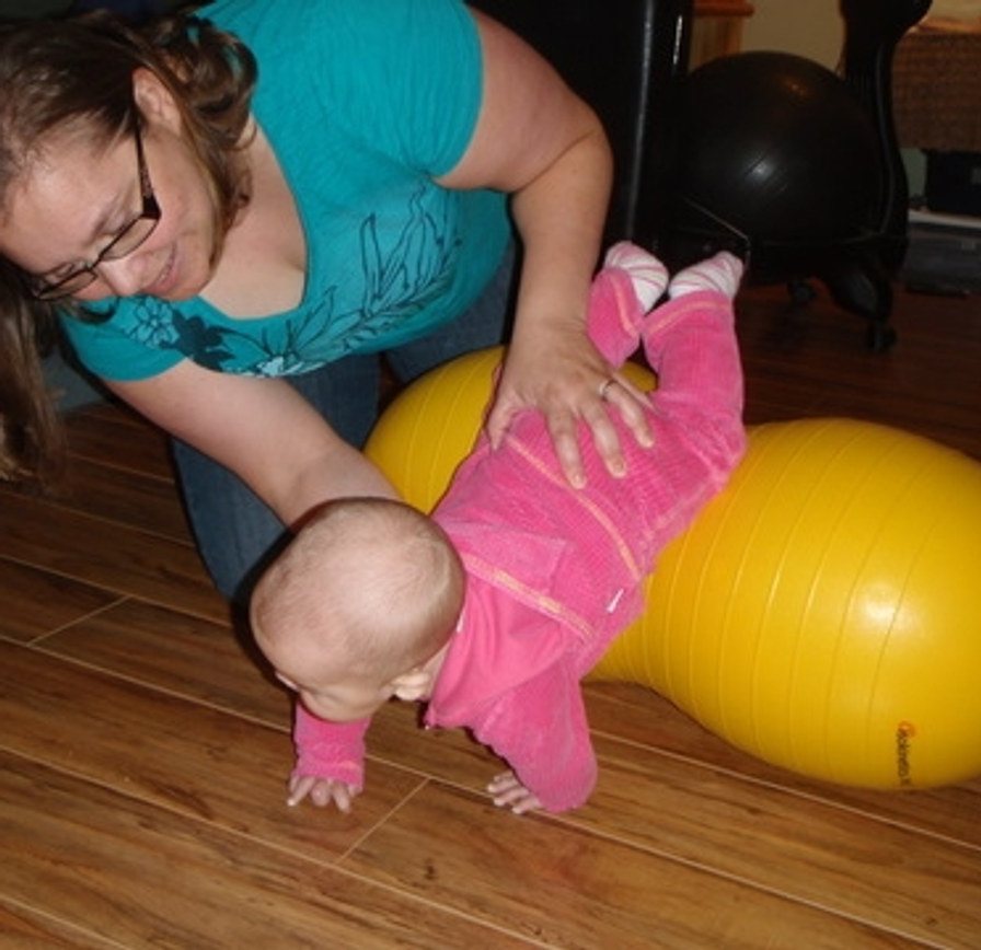 A therapist treating a baby over a gym ball