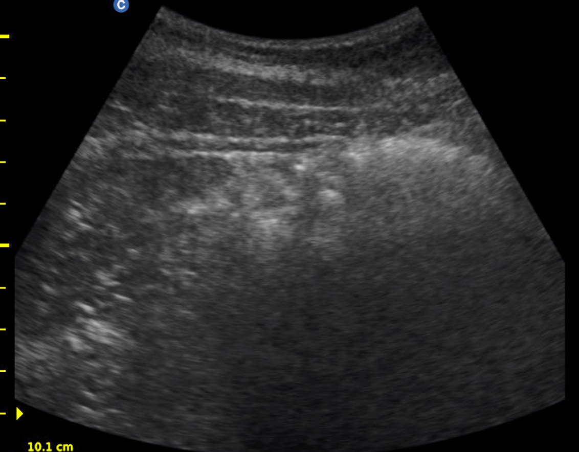 A core muscle imaged at rest